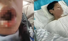 Vụ 2 nam sinh ép bạn uống nước sôi: Cách xử lý gây bất bình