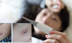 Sốt liên tục nhiều ngày không đỡ, nhập viện phát hiện mắc sốt mò