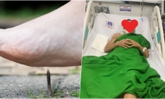 Phú Thọ: Chủ quan với chiếc đinh gỉ, người đàn ông nguy kịch