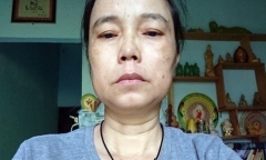 Nữ chủ hụi ôm tiền trốn truy nã 26 năm