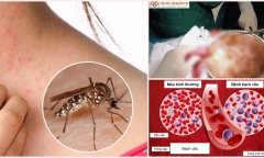 Tin tức đời sống mới nhất ngày 1/9: Phát hiện hơn trăm con giun đũa trong bụng bé 64 tháng tuổi