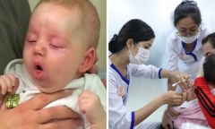 Xuất hiện ca ho gà đầu tiên ở Hà Nội là bé gái 6 tuần tuổi