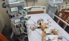 Bé 8 tháng tuổi tím tái toàn thân sau khi ngã vào thùng nước của gia đình