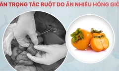 Bệnh nhi 7 tuổi tắc ruột vì ăn loại quả yêu thích của nhiều gia đình