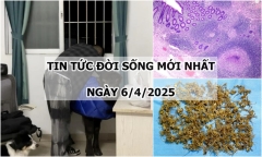 Tin tức đời sống 6/4: Đi khám do đau bụng, phát hiện bị viêm ruột thừa do lao