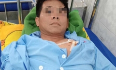 Người đàn ông bị chó becgie nhà nuôi 