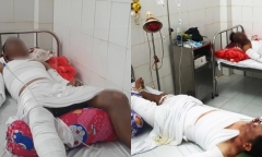 Cà Mau: Hầm máy ghe lưới ghẹ phát nổ, ba người bỏng nặng