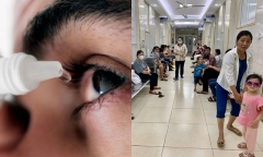 Chủ quan với bệnh đau mắt đỏ nhiều người tự ý mua thuốc điều trị tại nhà dẫn đến biến chứng nặng