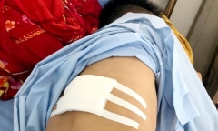 Tin tức pháp luật mới nhất ngày 8/8: Điều tra vụ nam thanh niên bị kẻ lạ chém trọng thương
