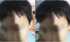 Vụ bé trai 10 tuổi nghị bị mẹ kế bạo hành: Khởi tố vụ án