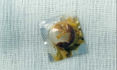 Tin tức đời sống ngày 28/4: Cụ ông 71 tuổi nuốt viên thuốc còn nguyên vỏ nhựa sắc cạnh