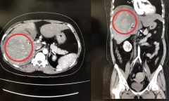 Tin tức đời sống ngày 24/2: Người phụ nữ vỡ gan vì dùng vật quen thuộc này để giảm cân