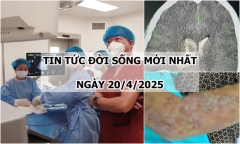 Tin tức đời sống 20/4: Bé trai 14 tuổi rơi vào hôn mê sau cơn đau đầu dữ dội