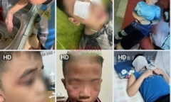 Vụ hàng loạt học sinh tại Hà Nội bị dị ứng do thuốc diệt muỗi: Chuyên gia lý giải