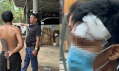 Đến nhà khách nữ lấy tiền hàng, nam shipper bị chồng người phụ nữ tấn công phải khâu 24 mũi