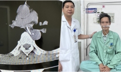 Phú Thọ: Đang ăn thịt gà, người đàn ông phải suýt mất mạng vì nguyên nhân ít ai ngờ tới