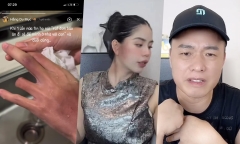  Hằng Du Mục bị chồng đánh bầm tím mặt, đăng story ẩn ý đây không phải lần đầu
