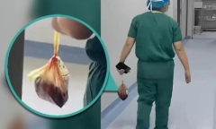 Bác sĩ Trung Quốc gây phẫn nộ khi đánh cắp nhau thai của sản phụ