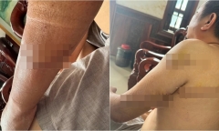 Danh tính 3 nghi phạm truy sát người đàn ông ở Đồng Nai