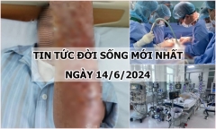 Tin tức đời sống ngày 14/6/2024: Hãi hùng cánh tay lở loét sau khi bị mèo cào