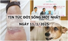 Tin tức đời sống 11/1: Người đàn ông gặp họa vì bôi dầu nóng chữa gãy xương
