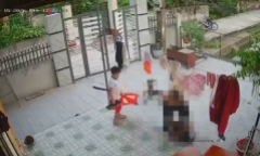 Bé trai 11 tuổi ở Hưng Yên bị người đàn ông đánh tới nhập viện