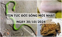 Tin tức đời sống 30/10/2024: Bé trai 16 tháng tuổi mắc bệnh hiếm gặp Kawasaki