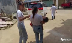 Bé gái 2 tuổi bất cẩn ngã từ cầu thang tầng 2 xuống, tình trạng đứa trẻ khiến ai nấy ám ảnh