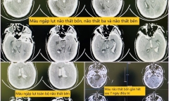 Người đàn ông bất ngờ đau đầu rồi gục xuống ghế khi đang làm việc tại cơ quan