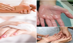 Nguyên nhân và cách khắc phục mồ hôi tay, mồ hôi chân hiệu quả