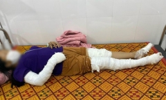 Nghệ An: Dựng cây nêu vướng đường dây cao thế, 3 người bị điện giật 