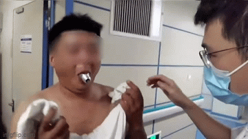 Thực hiện thử thách nhét bóng đèn vào miệng, người đàn ông rơi vào tình huống 