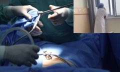 Bác sĩ bỏ quên bệnh nhân khi đang gây tê, lý do đằng sau khiến ai cũng 