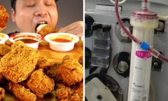 Liên tục ăn trưa với gà rán, huyết tương chàng trai chuyển màu bất thường