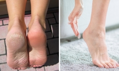 Hiện tượng hay gặp khi đông đến gây đau đớn, 