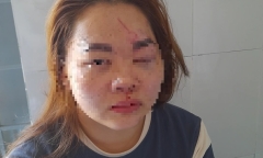Xác minh thông tin thầy giáo cấp 2 đánh vợ nhập viện