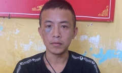 Vụ chém 3 người trọng thương ở Hà Nội: Nghi phạm có bệnh án tâm thần