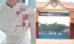 Mẹ nữ sinh bị bạn đánh chấn thương đầu: 