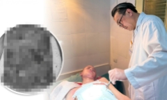 Tự ý đắp thuốc nam chữa bỏng cồn, bé trai 14 tuổi bị hoại tử nặng