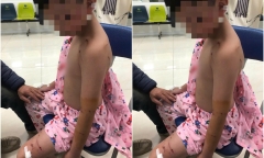 Bé trai 10 tuổi bị chó tấn công, trên người có nhiều vết thương