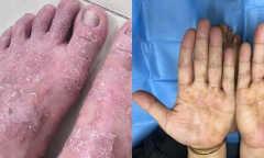 Cận Tết, Viện Huyết học kêu gọi cộng đồng hiến 10.000 đơn vị máu