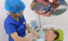 Ăn mật cá trôi để bồi bổ, bệnh nhân U80 nhập viện cấp cứu chỉ sau 1 ngày