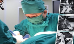 Nối thành công cẳng chân gần bị đứt rời cho người đàn ông do bị “chém”