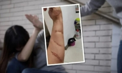 Sẵn sàng lấy thân đỡ 20 nhát chém cứu bạn, cô gái không ngờ bạn lại là người “vong ân bội nghĩa”