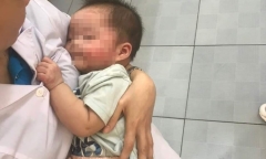 Nhói lòng bé gái 7 tháng tuổi bị bỏ rơi vệ đường, người chi chít vết muỗi đốt