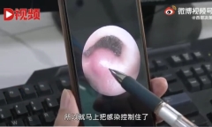 Bé trai 8 tuổi suýt mất mạng vì nhiễm trùng não, bác sĩ cảnh báo dừng ngay thói quen nhiều người mắc phải