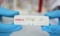 Vì sao test nhanh COVID-19 có vạch mờ, vạch đậm? Cách hạn chế 
