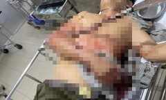Tổ trưởng dân phòng bị đâm xuyên cánh tay khi ngăn chặn hỗn chiến