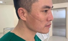 Nghẹn ngào bài thơ nghĩa tình của nam điều dưỡng trên tuyến đầu chống dịch COVID-19