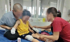 Vụ nghi nổ pháo tự chế ở Đắk Lắk: Bé trai bị đứt lìa hai bàn tay, khóc liên tục 20 tiếng/ngày 